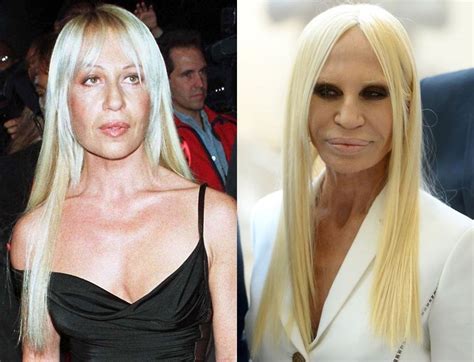 day before donatella versace|donatella versace before and after surgery.